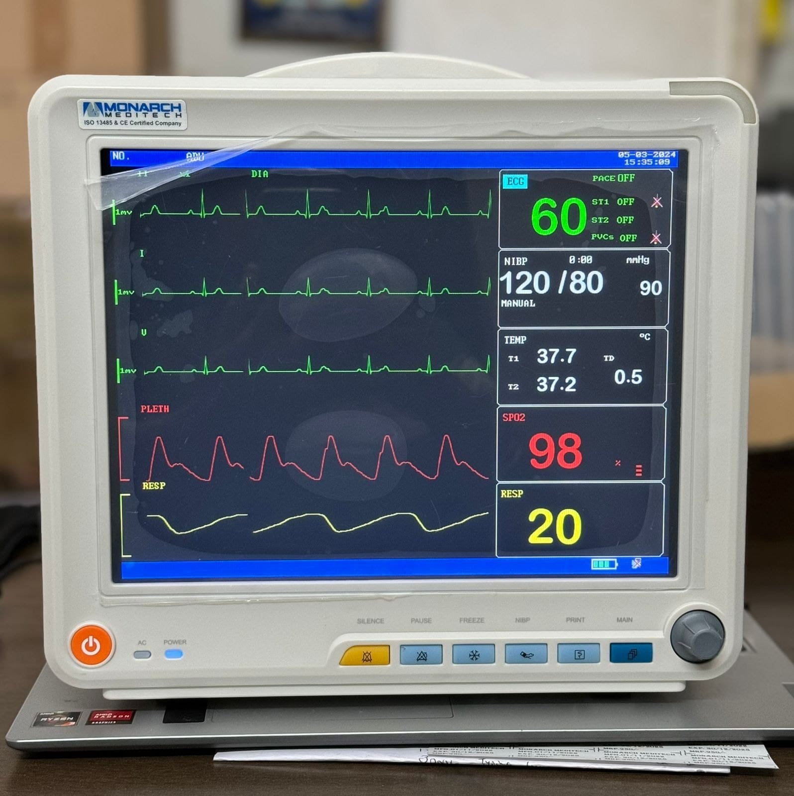 Cardiac Monitor
